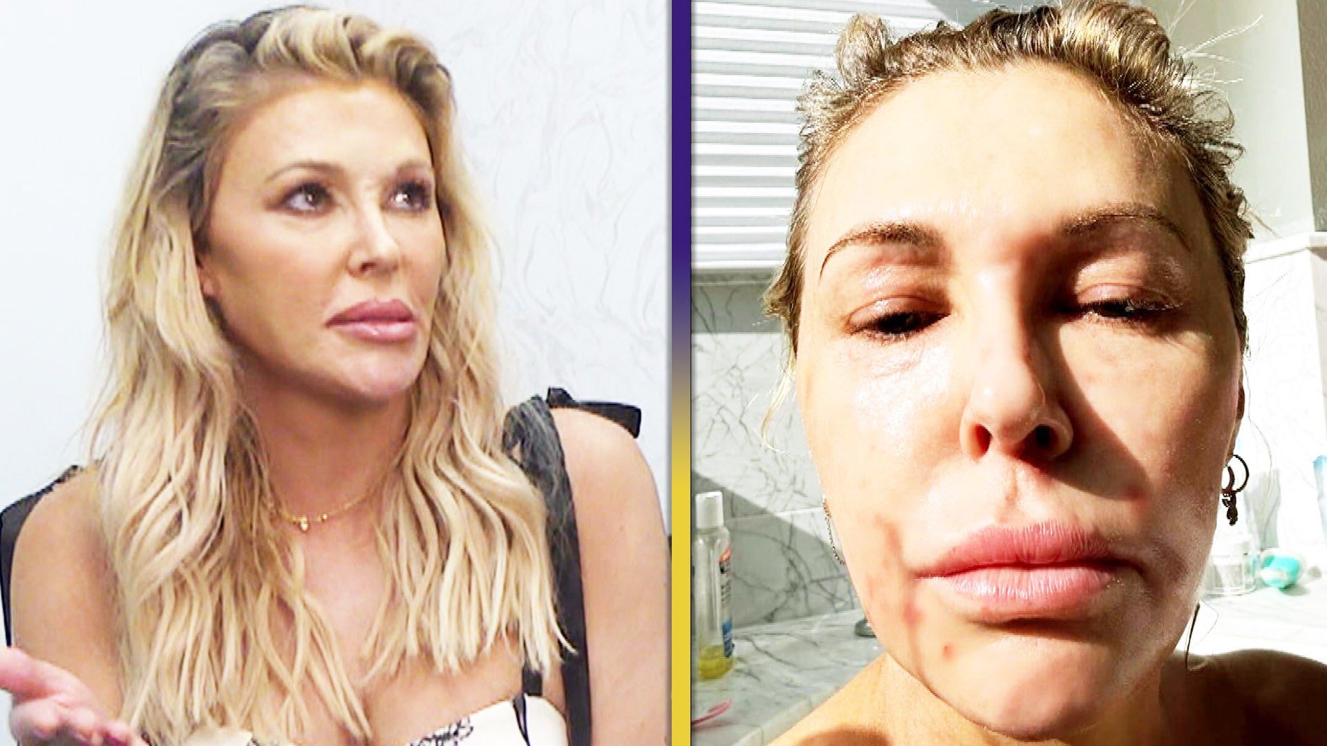 Brandi Glanville Opens Up About Stress Induced Health Issues After   ETD SHOWCLIP B02 BRANDI GLANVILLE 010224 CR 16x9 